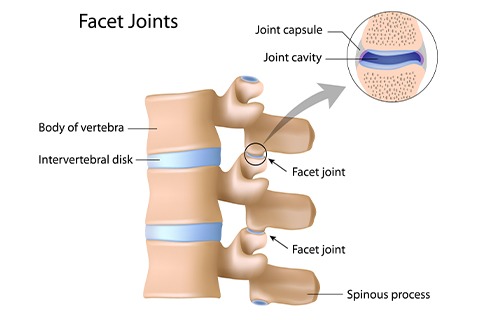 facet joints