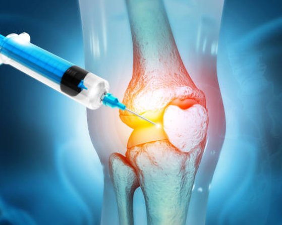 Pain on the Inside of the Knee: Causes, Symptoms, Structures, Investigations, and Regenerative Treatments