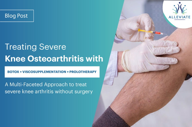 <span>Treating Severe Knee Osteoarthritis with BOTOX + VISCOSUPPLEMENTATION + PROLOTHERAPY: A Multi-Faceted Approach to treat severe knee arthritis without surgery</span>