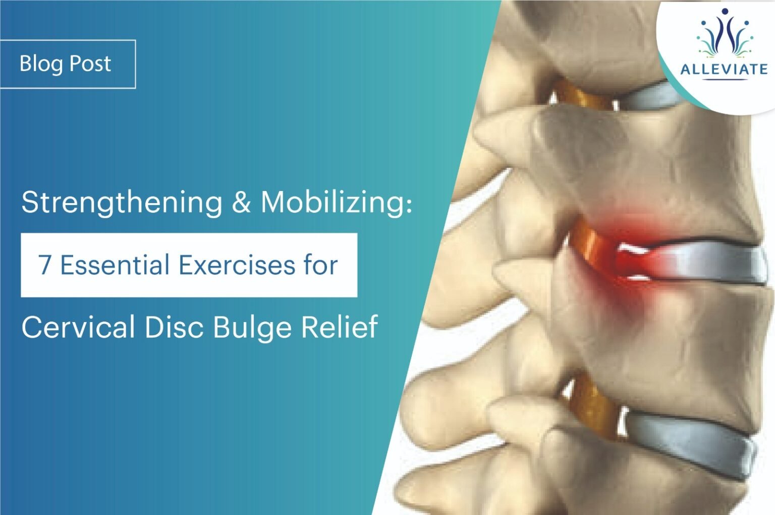 7 Essential Exercises for Cervical Disc Bulge Relief Alleviate Pain