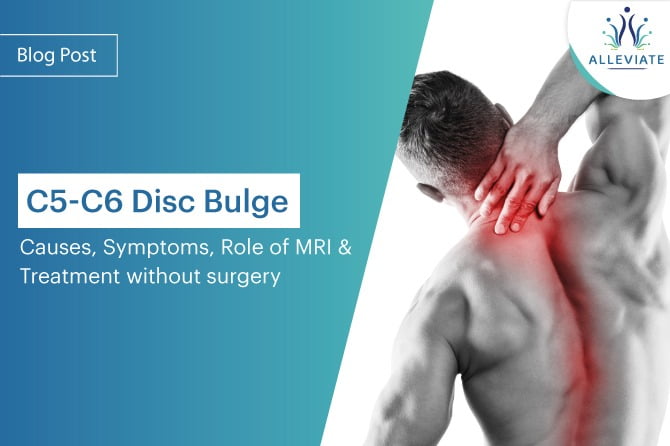 <span>C5-C6 Disc Bulge: Causes, Symptoms, Role of MRI, and Treatment without surgery</span>