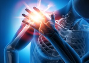 Frozen shoulder
