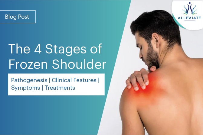 <span>The 4 Stages of Frozen Shoulder: Pathogenesis, Clinical Features, Symptoms, and Treatments</span>