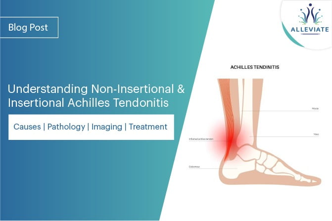 <span>Understanding Non-Insertional and Insertional Achilles Tendonitis : Causes | Pathology | Imaging | Treatment</span>