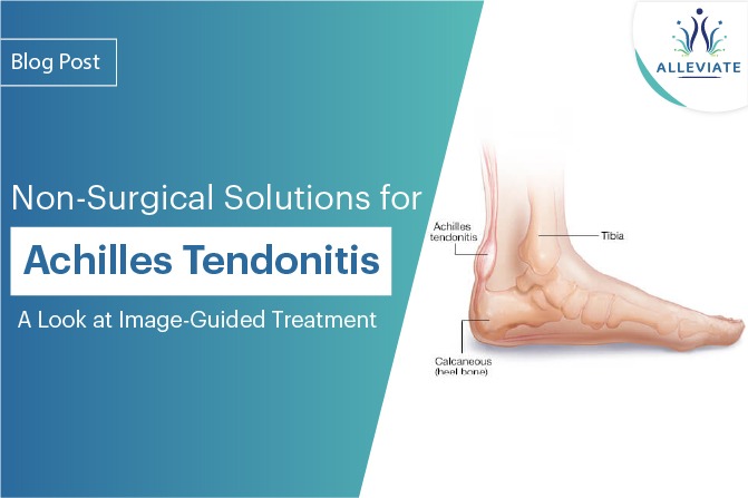 <span>Non-Surgical Solutions for Achilles Tendonitis: A Look at Image-Guided Treatment</span>