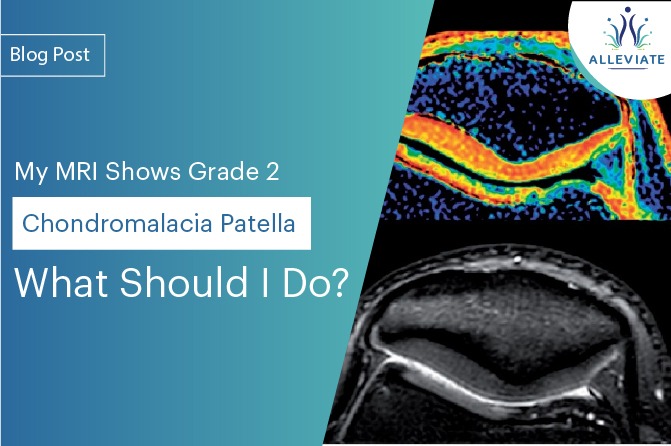 <span>My MRI Shows Grade 2 Chondromalacia Patella! What Should I Do?</span>