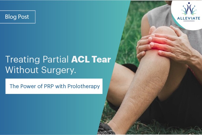 <span>Treating Partial ACL Tear Without Surgery: The Power of PRP with Prolotherapy</span>