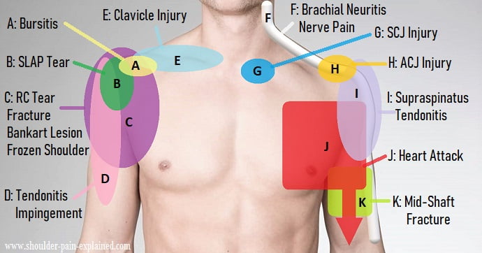 Shoulder Pain Treatments - Protherapy Clinic