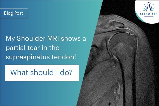 <span>“My Shoulder MRI shows a partial tear in the supraspinatus tendon ! What should I do?”</span>