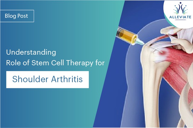 <span>Understanding Role of Stem Cell Therapy for Shoulder Arthritis</span>