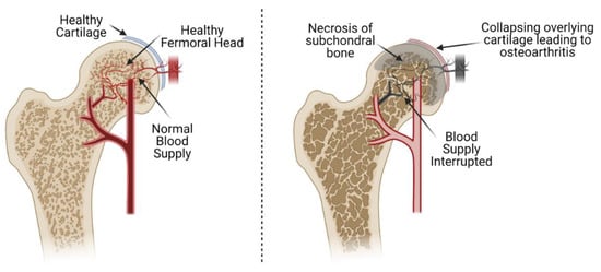 Healthy cartilage blog1