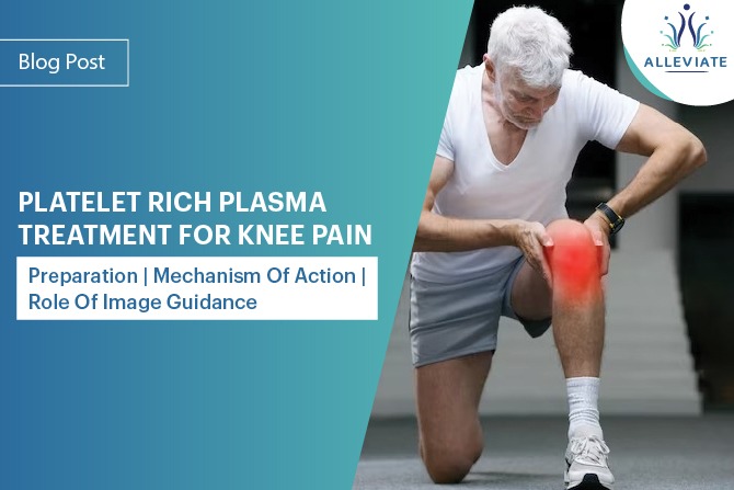 <span>PLATELET RICH PLASMA TREATMENT FOR KNEE PAIN- PREPARATION, MECHANISM OF ACTION AND ROLE OF IMAGE GUIDANCE</span>