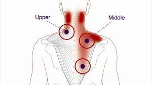 upper and middle trigger points